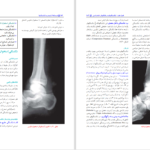 کتاب درسنامه ارتوپدی و شکستگی بهادر اعلمی هرندی PDF