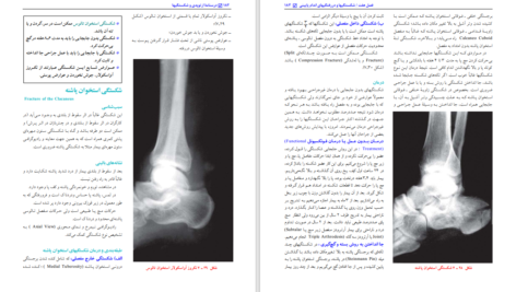کتاب درسنامه ارتوپدی و شکستگی بهادر اعلمی هرندی PDF